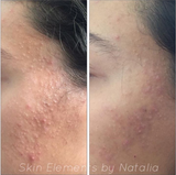 Eruption Emulsion